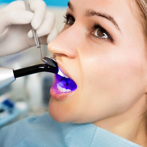 Dentist curing a tooth-colored filling