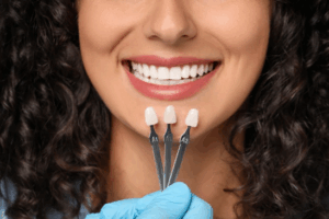 Dentist comparing dental veneers to a patient’s smile